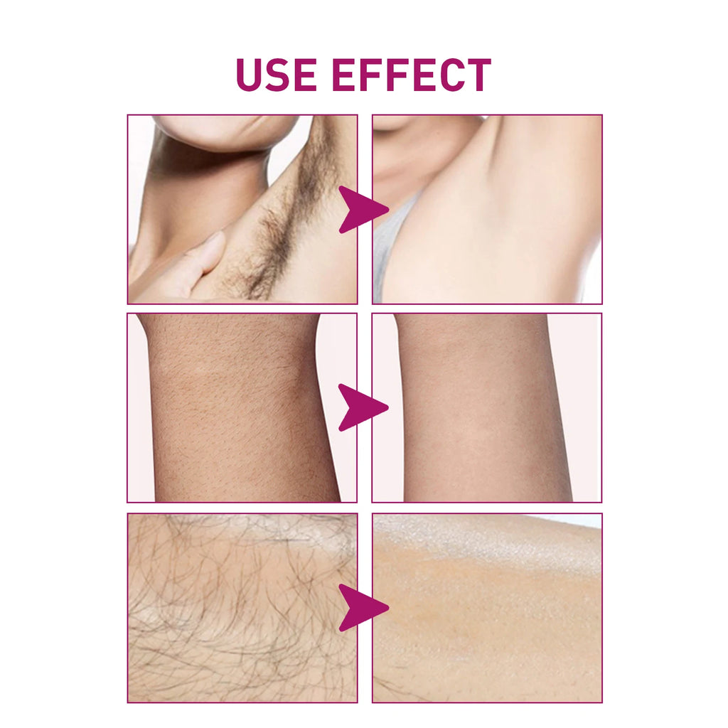 Permanent Hair Removal Cream for Men Soften Hair Growth Delay Reduce Skin Redness Painless Remove Armpit Bikini Depilatory Cream