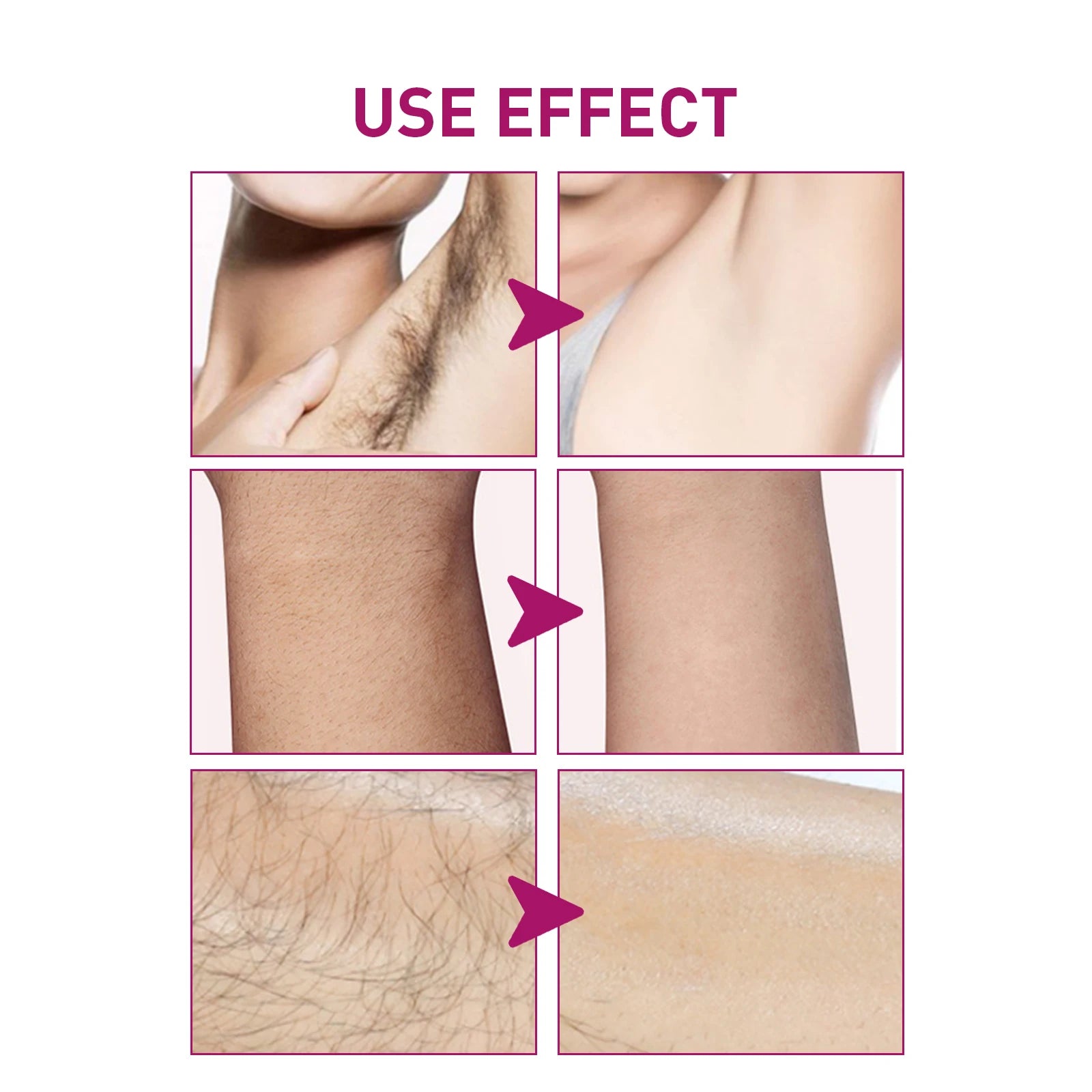 Permanent Hair Removal Cream for Men Soften Hair Growth Delay Reduce Skin Redness Painless Remove Armpit Bikini Depilatory Cream